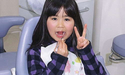 小児歯科とはイメージ画像
